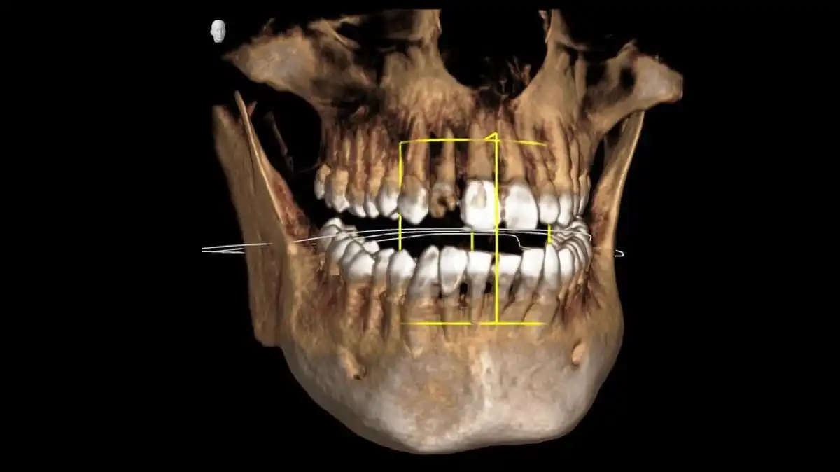Scopri di più sull'articolo Diagnostica 3D